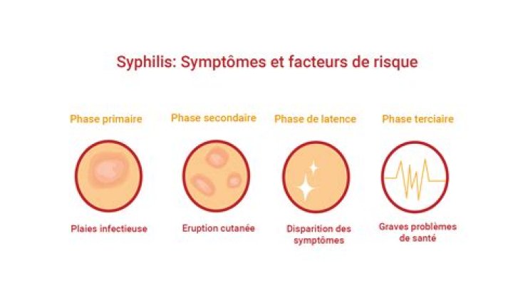 Quels sont les symptômes dune artère bouchée