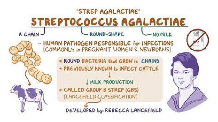 What is Streptococcus agalactiae in urine
